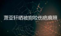 萧亚轩晒被狗咬伤疤痕照片：脸细胞坏死 还在养皮中